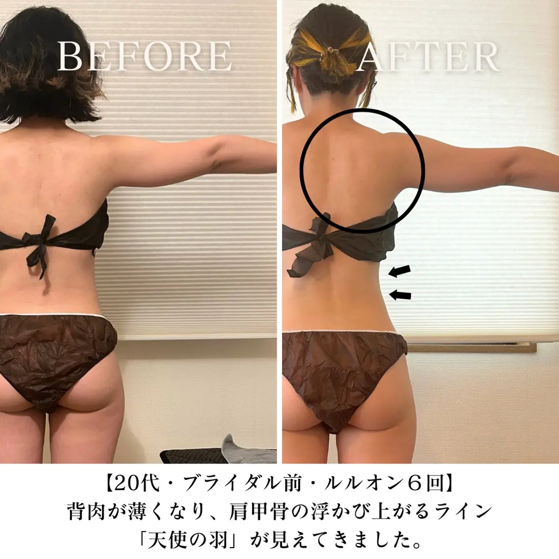 【ブライダル】LULUONN＋背中・腕集中してマッサージ♪NMN高濃度パック¥8800→¥7800の写真