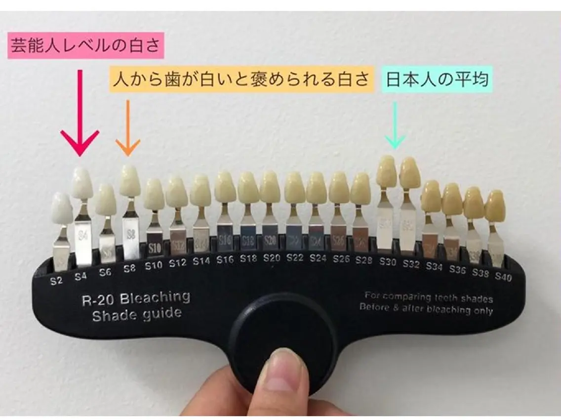 その他 セルフホワイトニング エクシア大宮東口店のその他イメージ