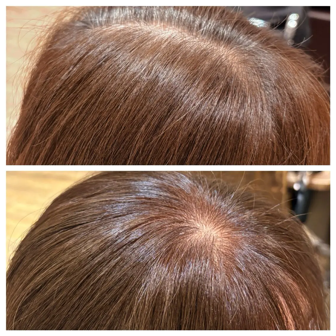 ミディアム ヘアカラー 痛くないシミ取り 【荻窪】石橋のヘアスタイル
