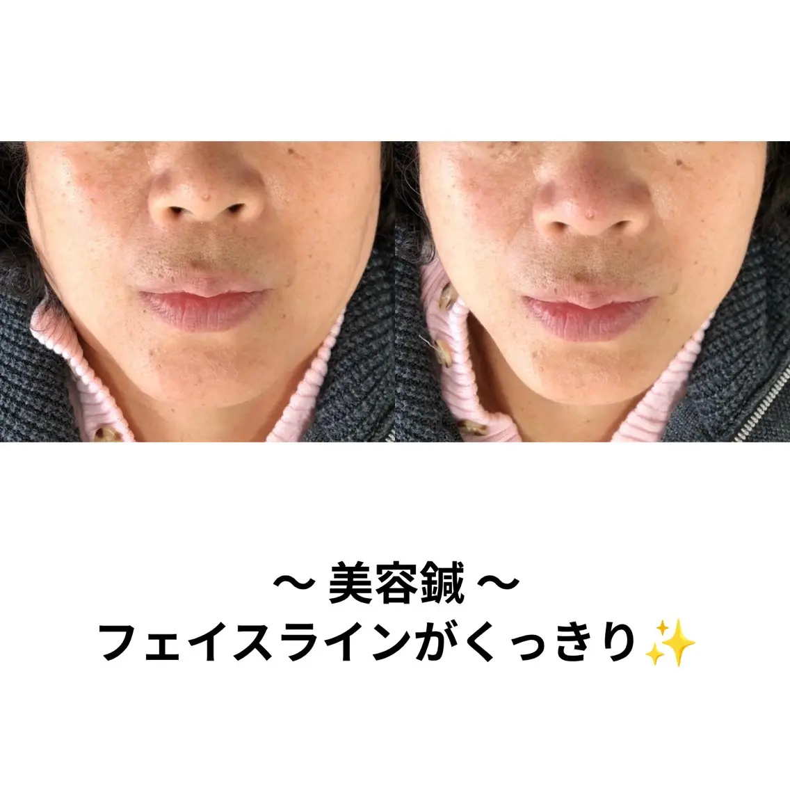 その他 髙中 沙樹のその他イメージ