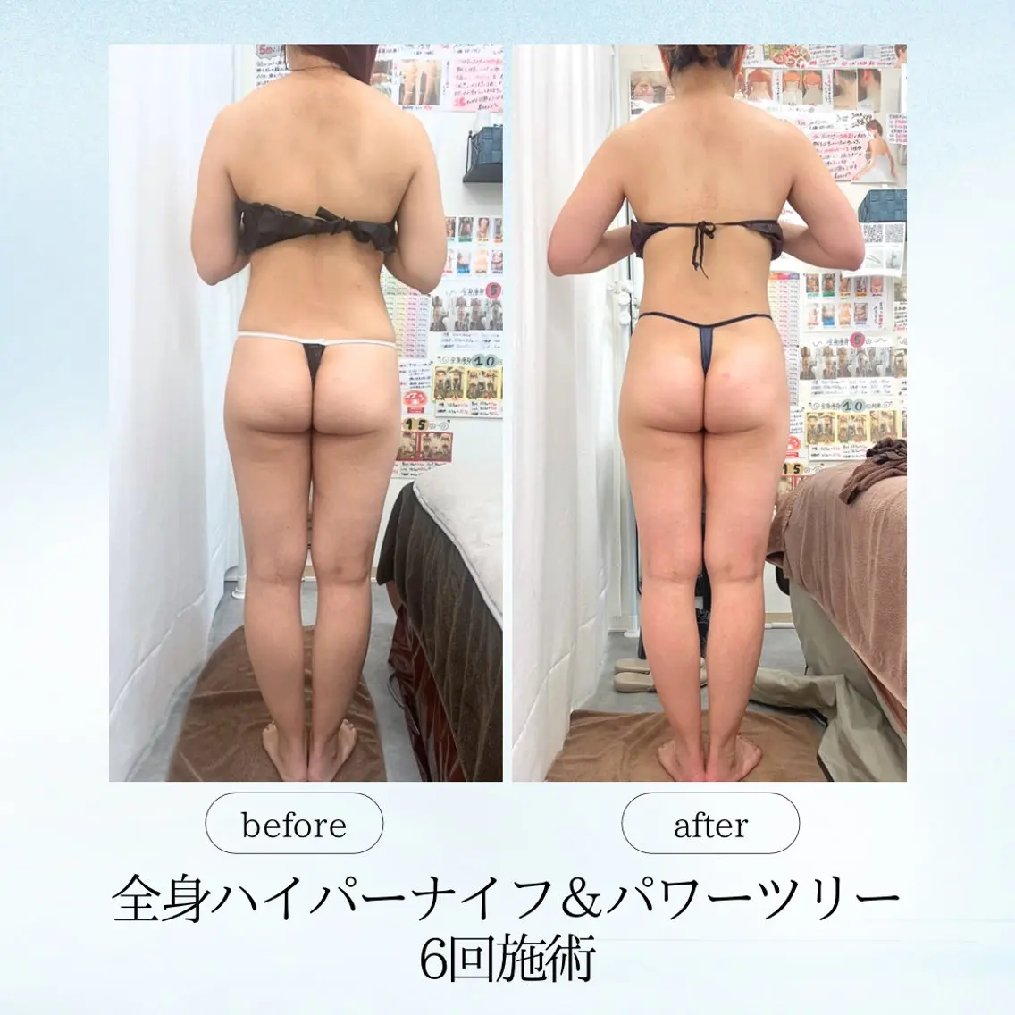 エステ リラク 《痩身、小顔専門店》 エスプレッソのエステ・リラクイメージ