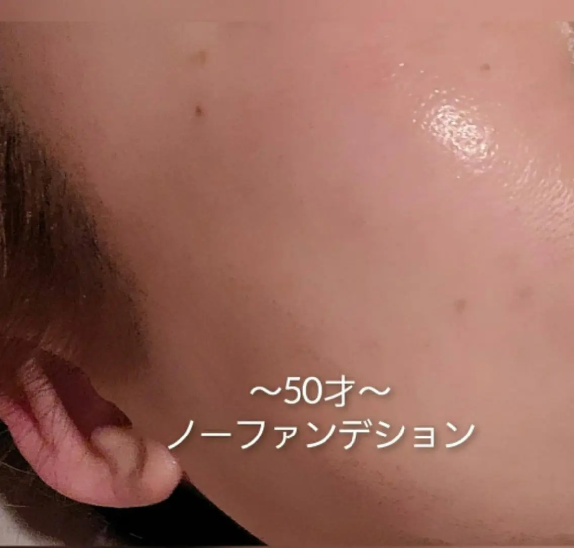 即実感✨韓国小顔✨クリニック監修【シワ・たるみ・皮膚トラブル】高濃度❗プラセンタ導入の写真
