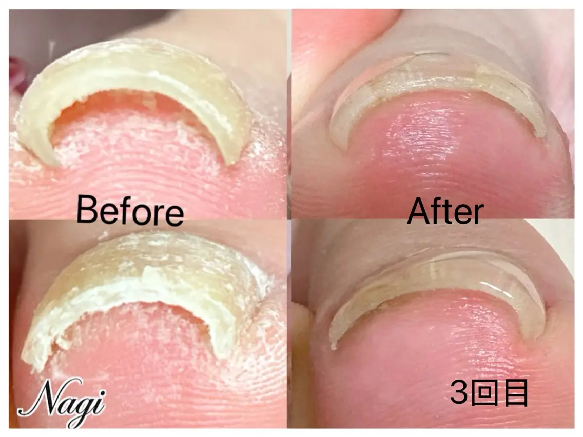 ネイル フットネイル Nagi  Nail 本山のネイルデザイン
