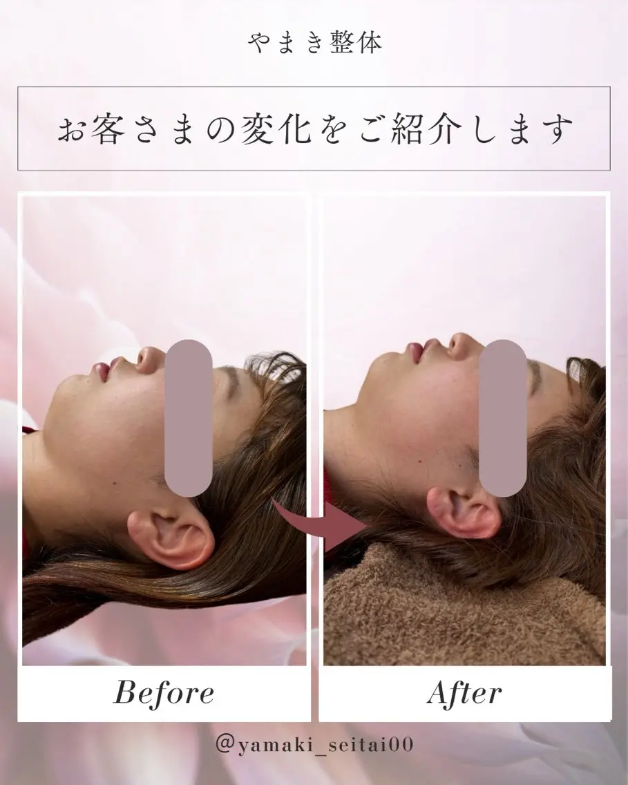 【本来の美しさへ】小顔整体体験！！の写真