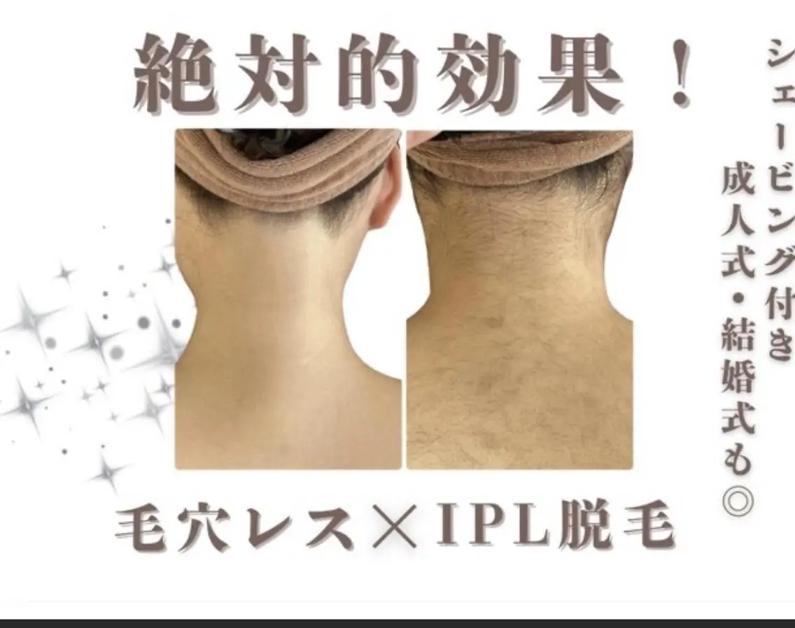 🌷MURA 毛穴・顔脱毛🌷のエステ・リラクイメージ