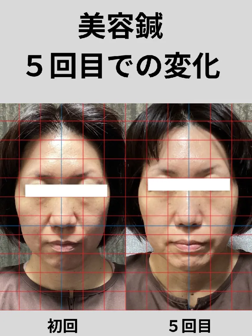 鍼灸整体院 アレンジのその他イメージ