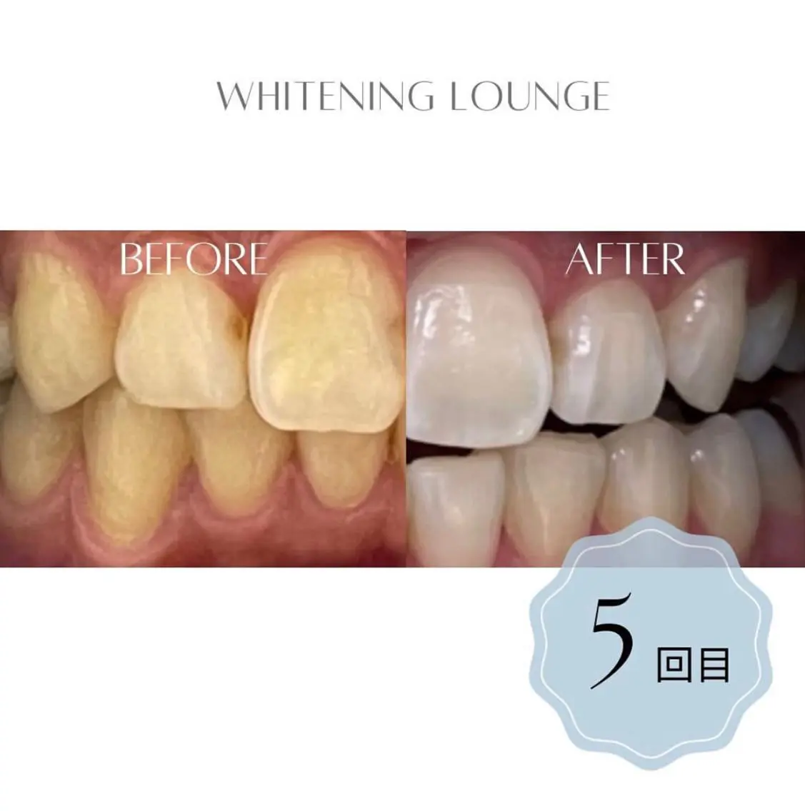 ホワイトニング Lounge横須賀のその他イメージ