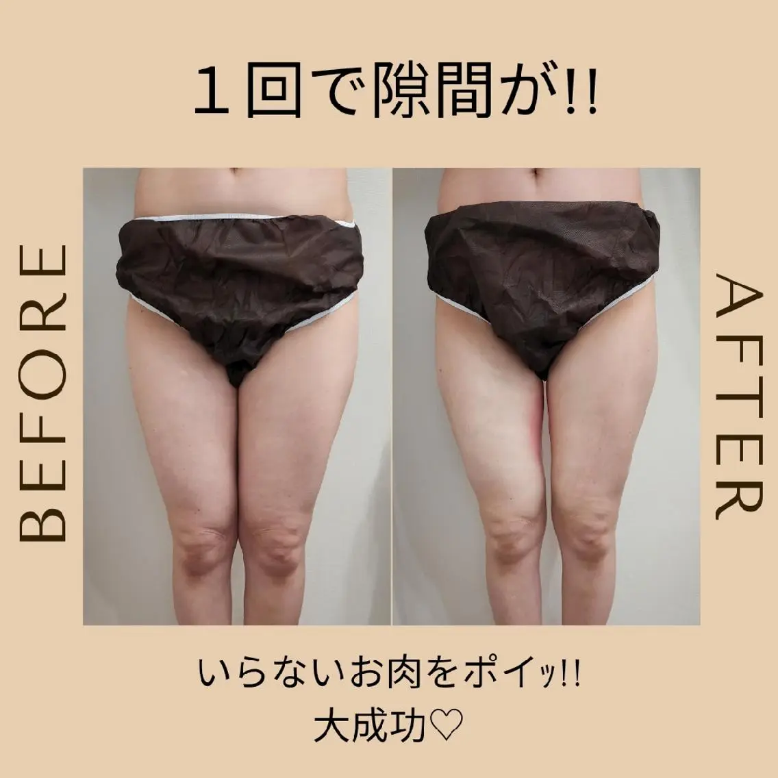 冷却・脱毛サロン coconoixのエステ・リラクイメージ