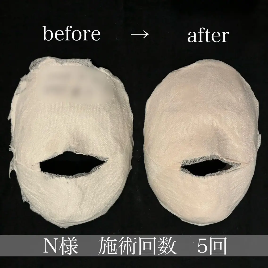 小顔サロン Moanaのエステ・リラクイメージ