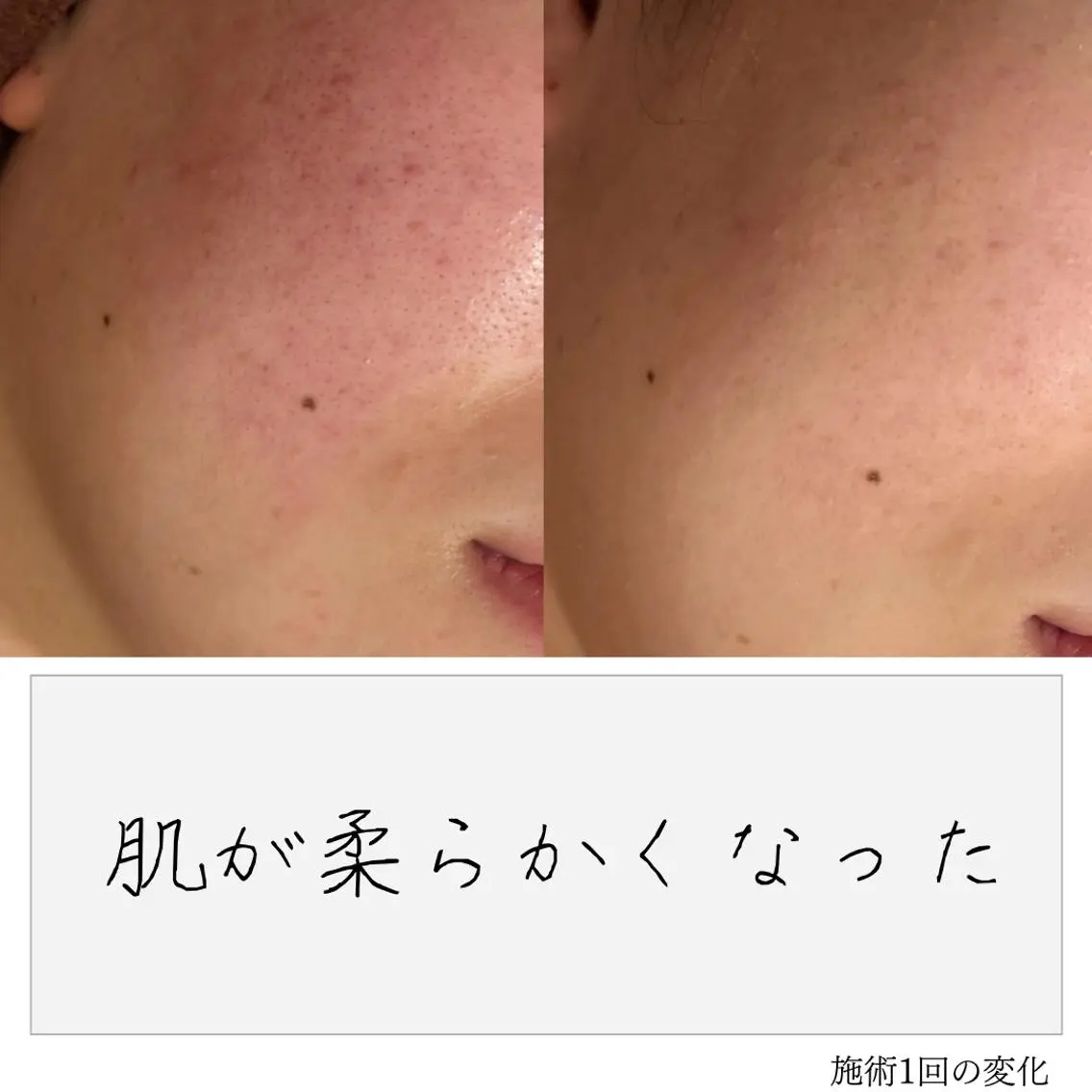 ニキビ経験者が施術 する専門サロン🌻のエステ・リラクイメージ