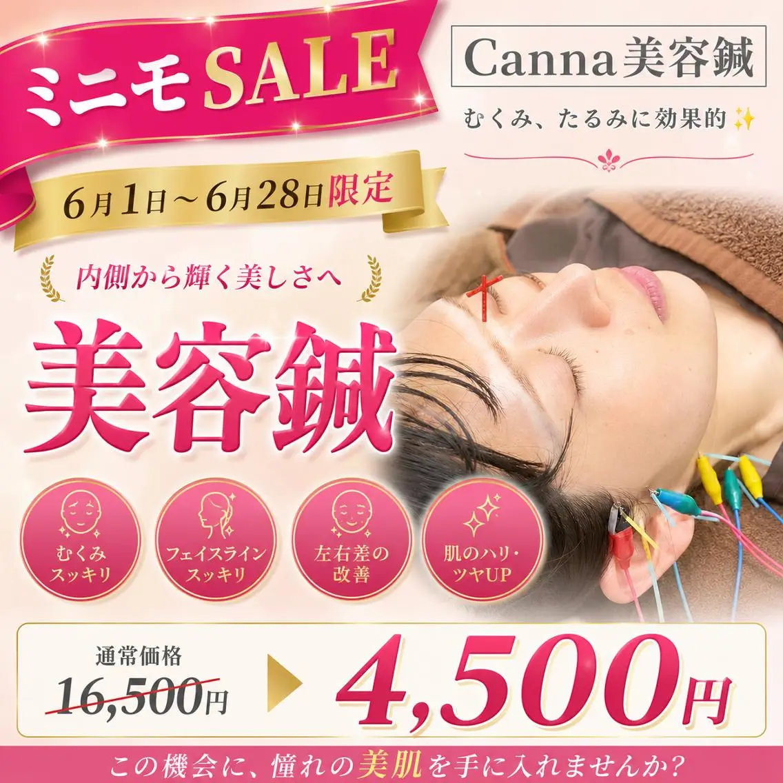 【6月1日~28日限定！】【浮腫み/たるみ/くすみ】90分⭐️美容鍼(顔鍼＋身体鍼+フェイシャルマッサージ)の写真
