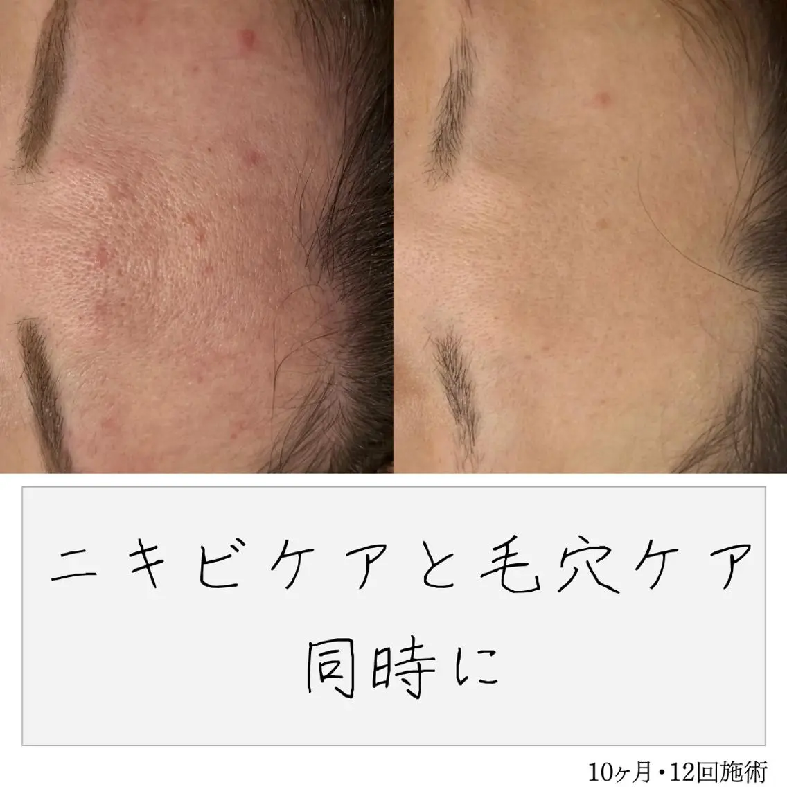 ニキビ経験者が施術 する専門サロン🌻のエステ・リラクイメージ
