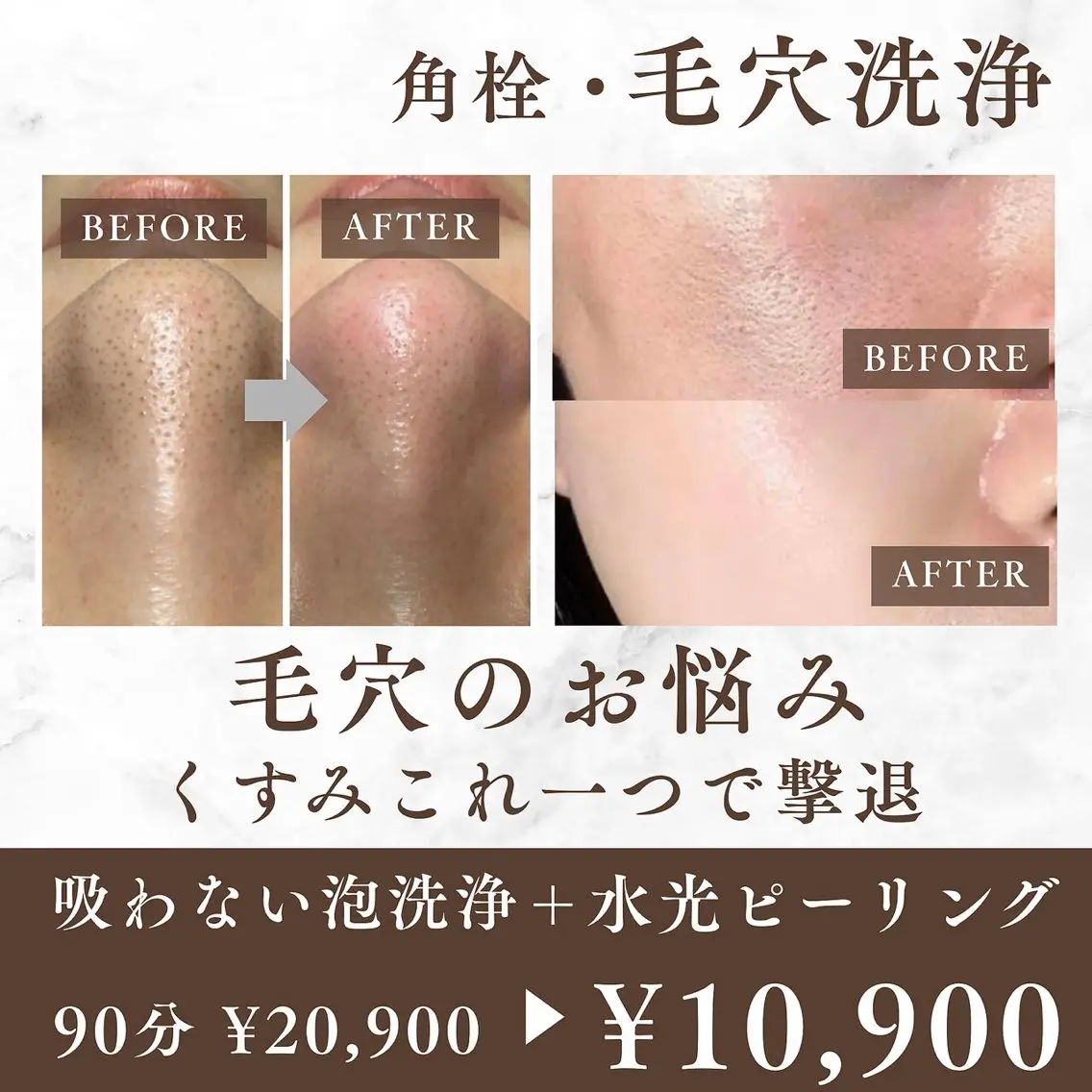 エステ 毛穴•肌質改善 EARNEST心斎橋のエステ・リラクイメージ