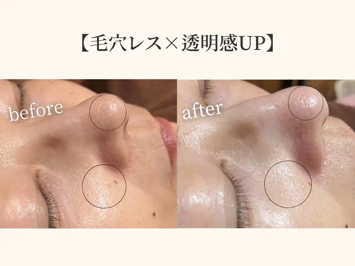 小顔矯正×毛穴サロン DRRAMSPA町田のエステ・リラクイメージ