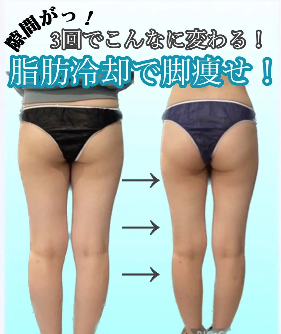 痩身ダイエット&小顔 🩷アールズスリムのエステ・リラクイメージ