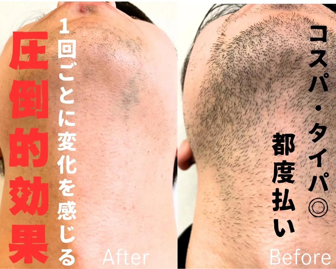 メンズ 脱毛 メンズ脱毛サロン BRIGHTのエステ・リラクイメージ