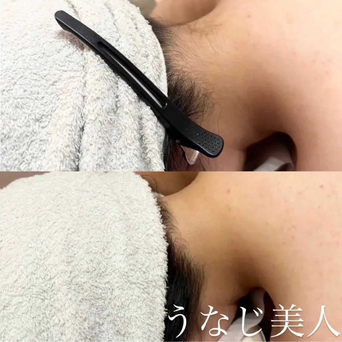 脱毛 SAERA Misuzuのエステ・リラクイメージ