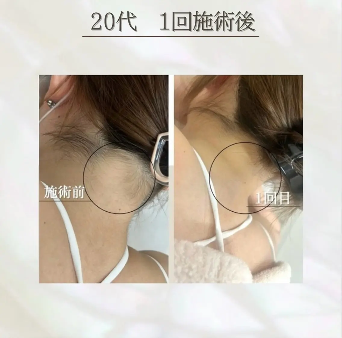 LED脱毛サロン 💐ayaのエステ・リラクイメージ