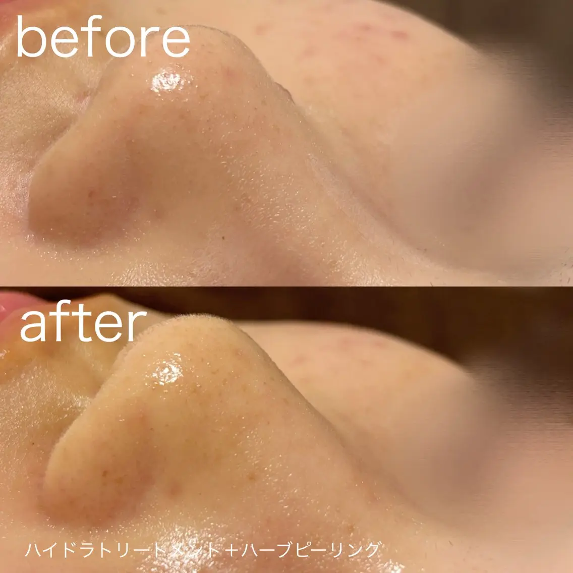 脱毛 lulularico Yuのネイルデザイン