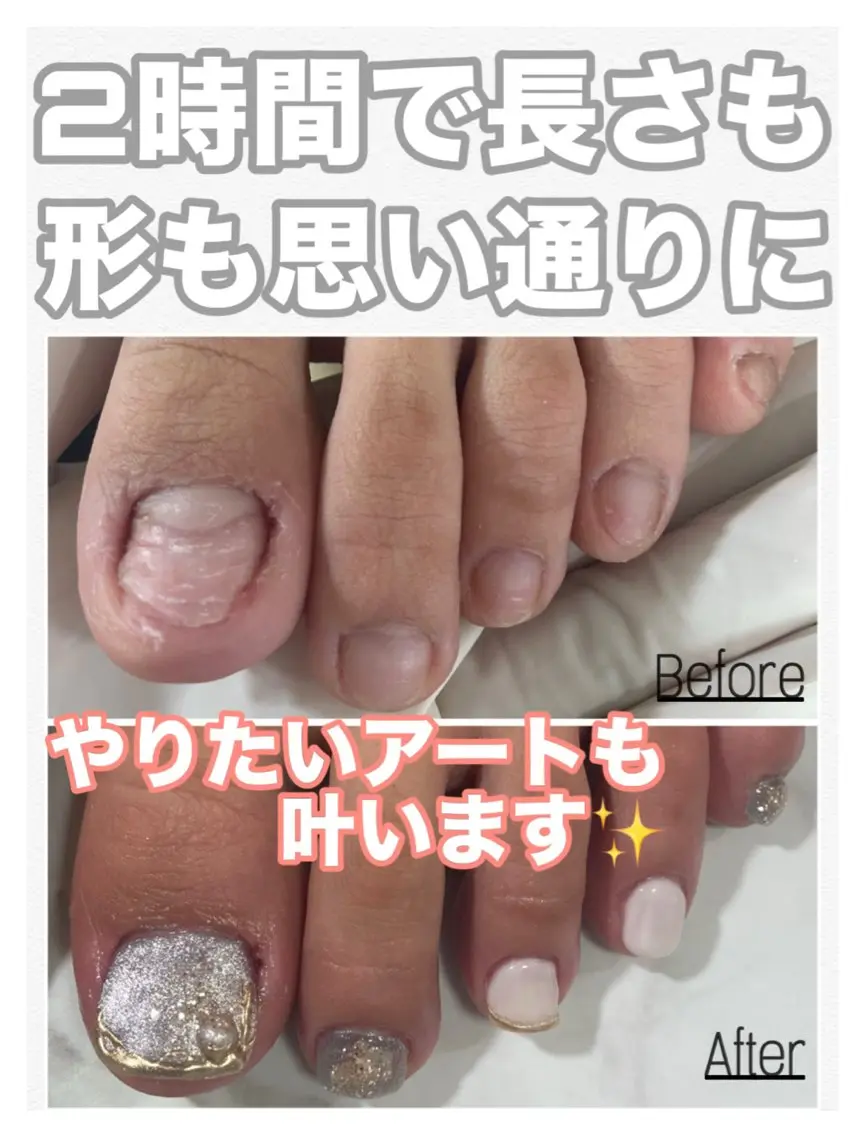 ネイル アートネイル 長さ出し フットネイル nail salon petillantのネイルデザイン