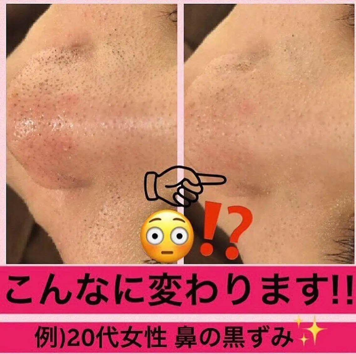 ミディアム カラー パーマ ヘアアレンジ メンズ キッズ ネイル マツエク・マツパ ニキビ・肌質改善専門 ♡人生が変わるサロンのエステ・リラクイメージ