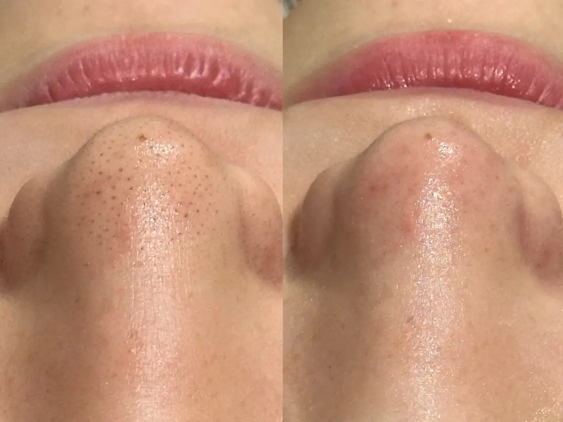 mumu beautyのエステ・リラクイメージ