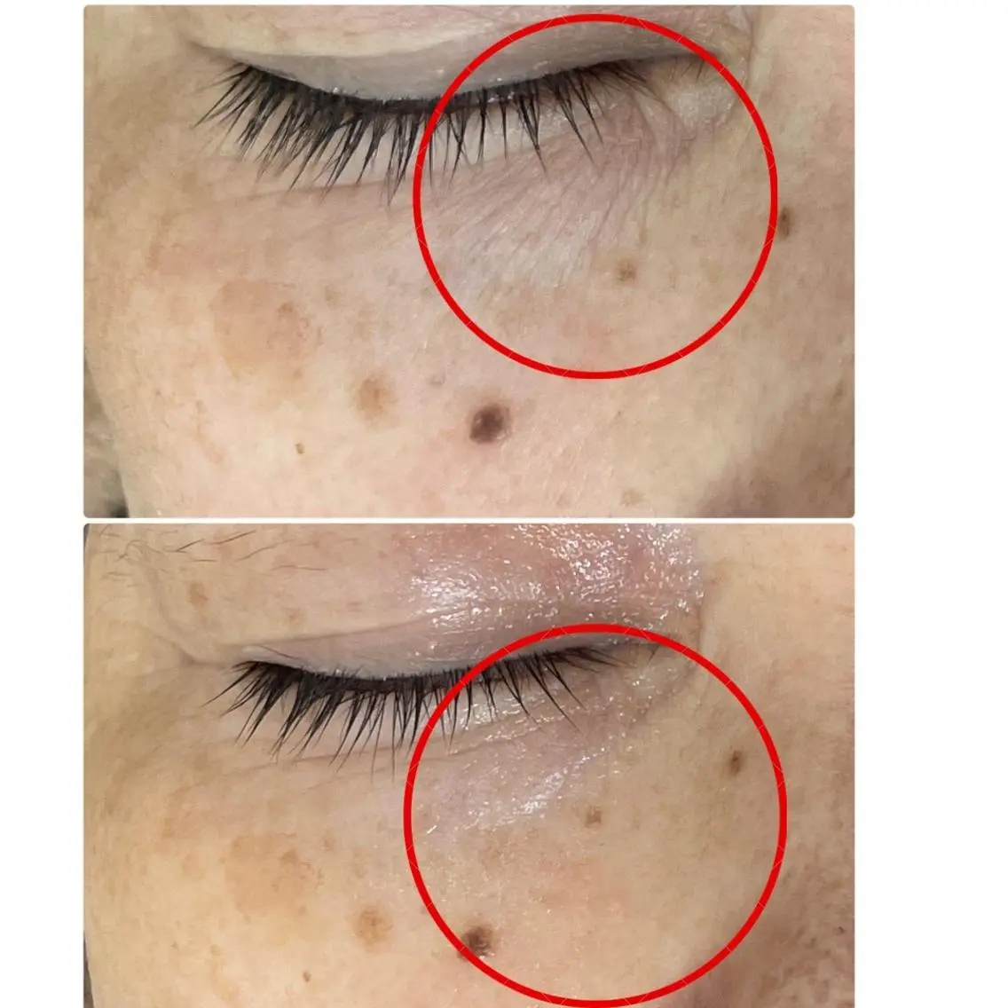 エステ 都度払い 肌質改善専門サロンのエステ・リラクイメージ