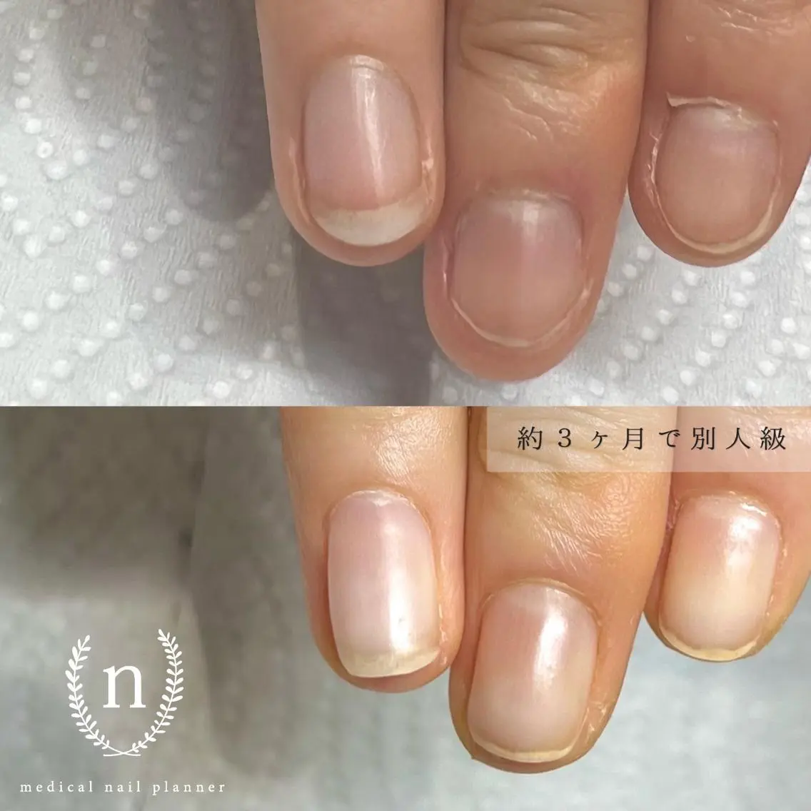 ネイル ハンドネイル 自爪育成専門サロン ◌𓈒azumiのネイルデザイン