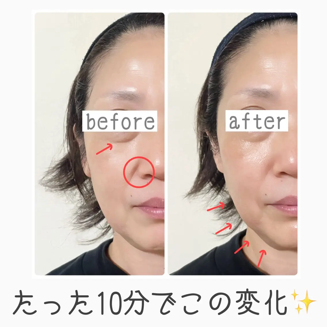 【期間限定】リフトアップ美顔器体験の写真
