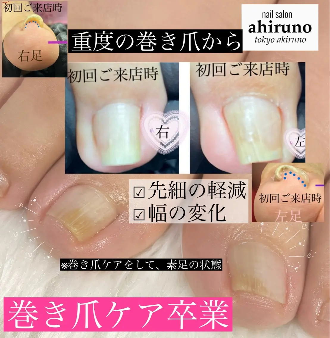 東京あきる野市ネイル ✿ ｙｕiのネイルデザイン
