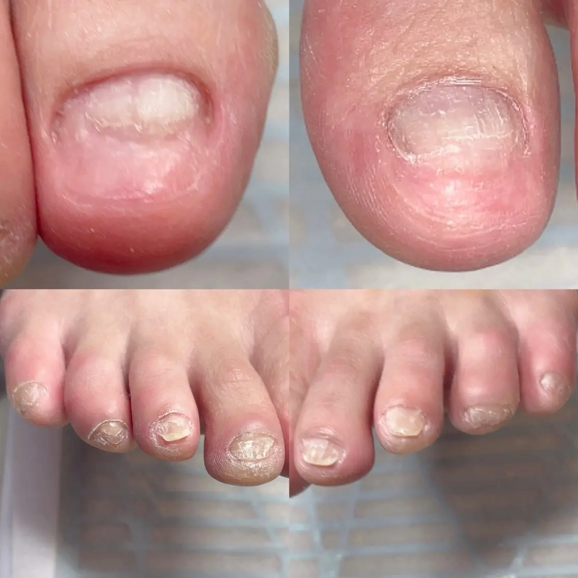 ネイル フットネイル ジェルネイル フットネイル .Nails Mio 赤羽西ネイルサロンのネイルデザイン
