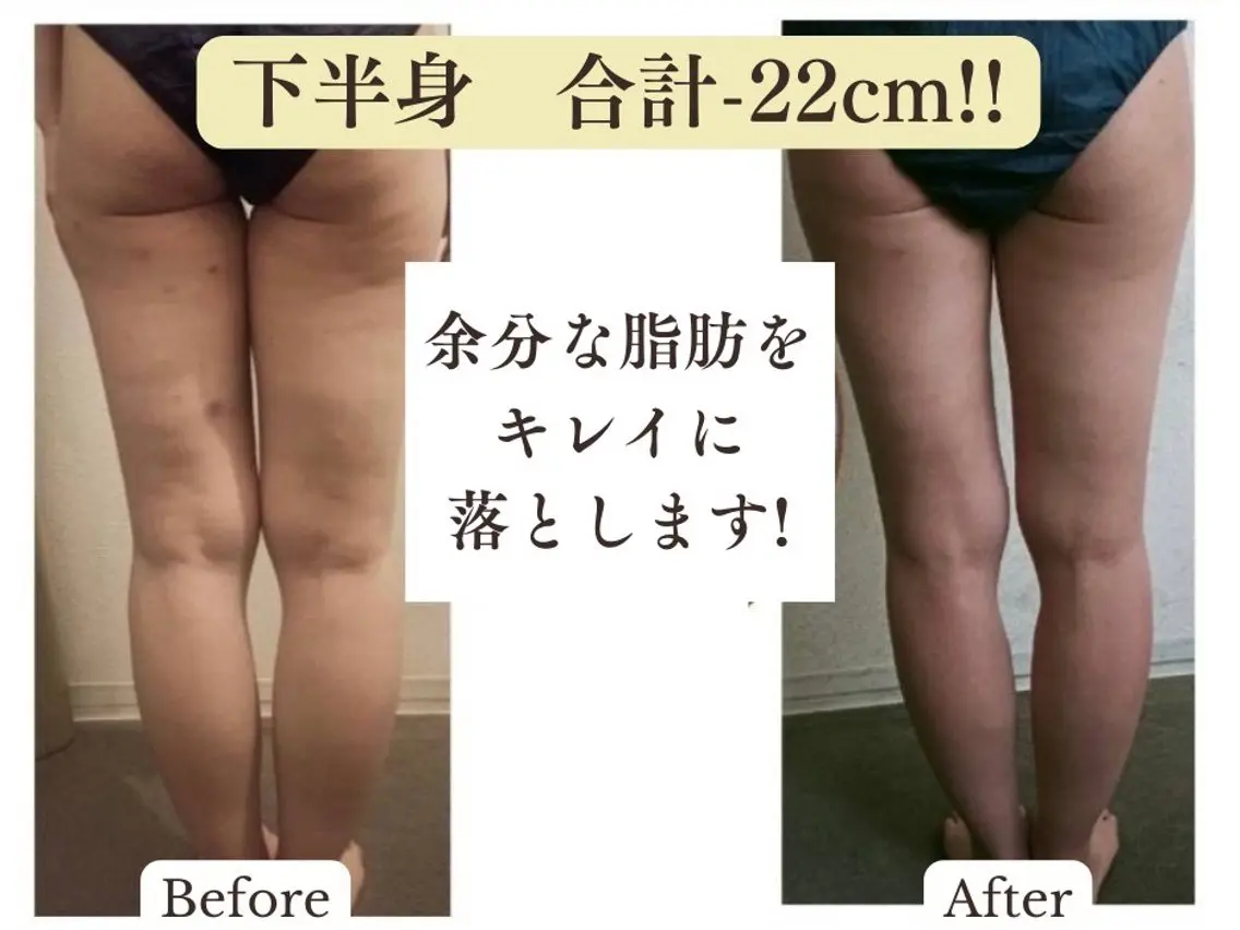 【目黒】本格痩身✴︎ 最新型よもぎ蒸しのエステ・リラクイメージ
