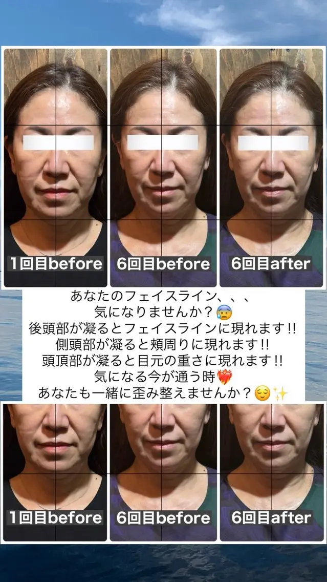 エステ リラク 💎後悔させない小顔 矯正💎イトヤマ🌱のエステ・リラクイメージ