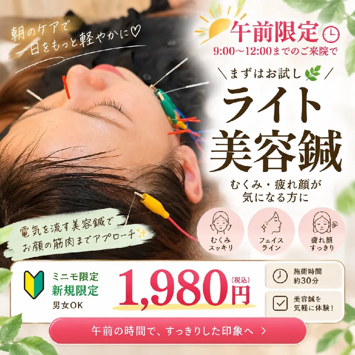 【平日午前限定!!】ライト美容鍼|むくみ・疲れ顔が気になる方にの写真
