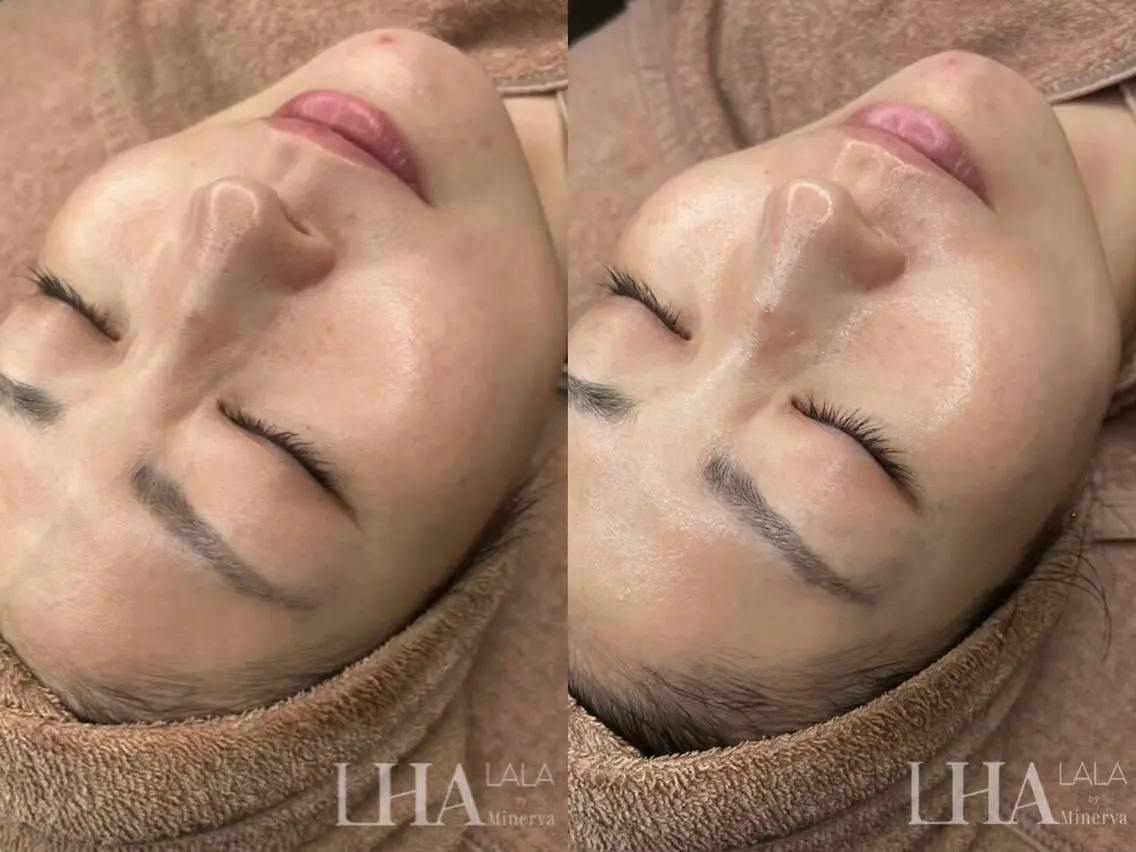 エステ リラク M FLOAT skin salonのエステ・リラクイメージ