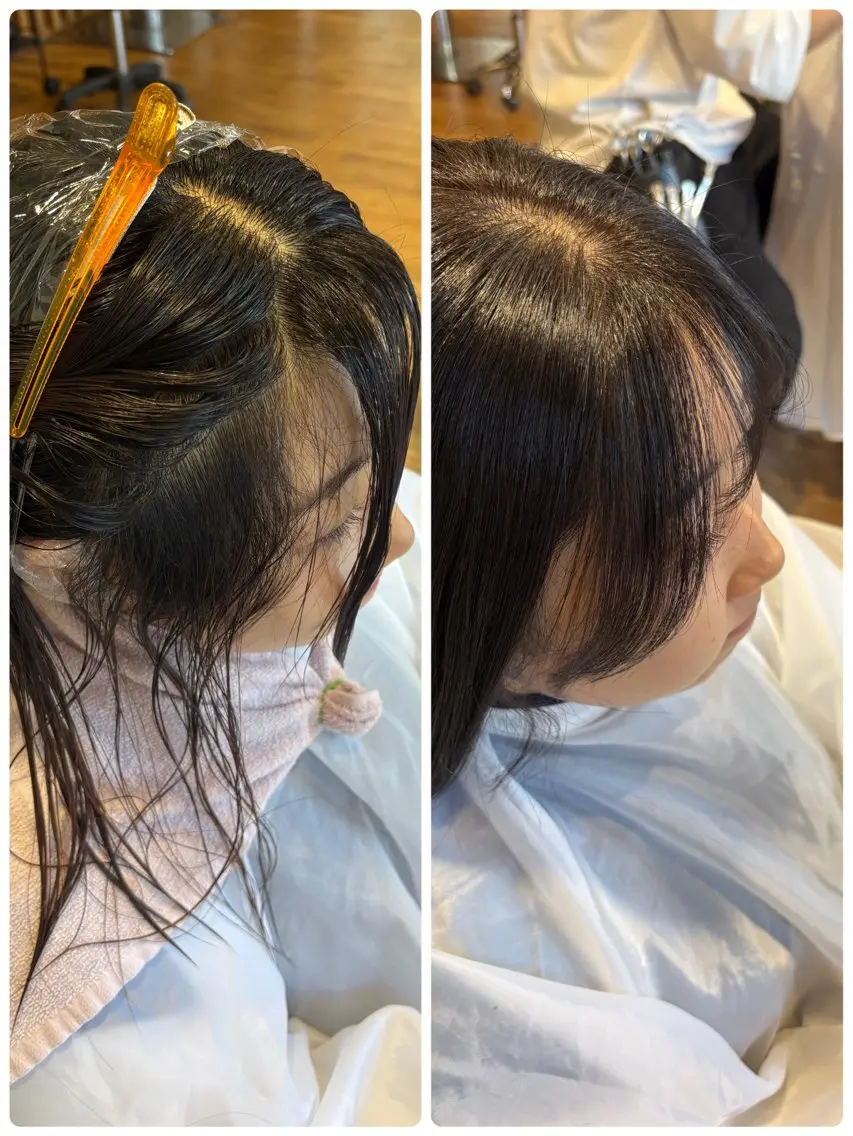 顔周り縮毛矯正＋トリートメントの写真