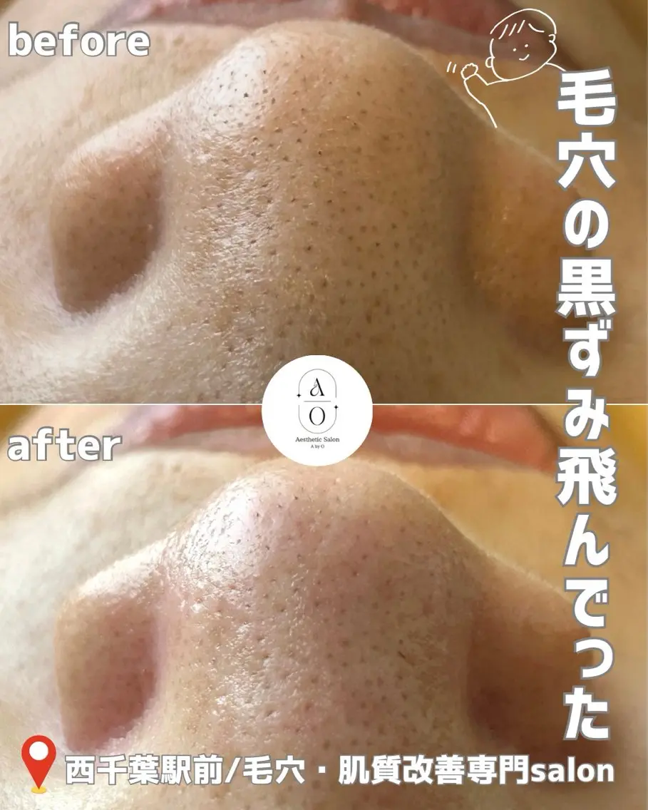 AxO Aestheticのマツエク・マツパデザイン