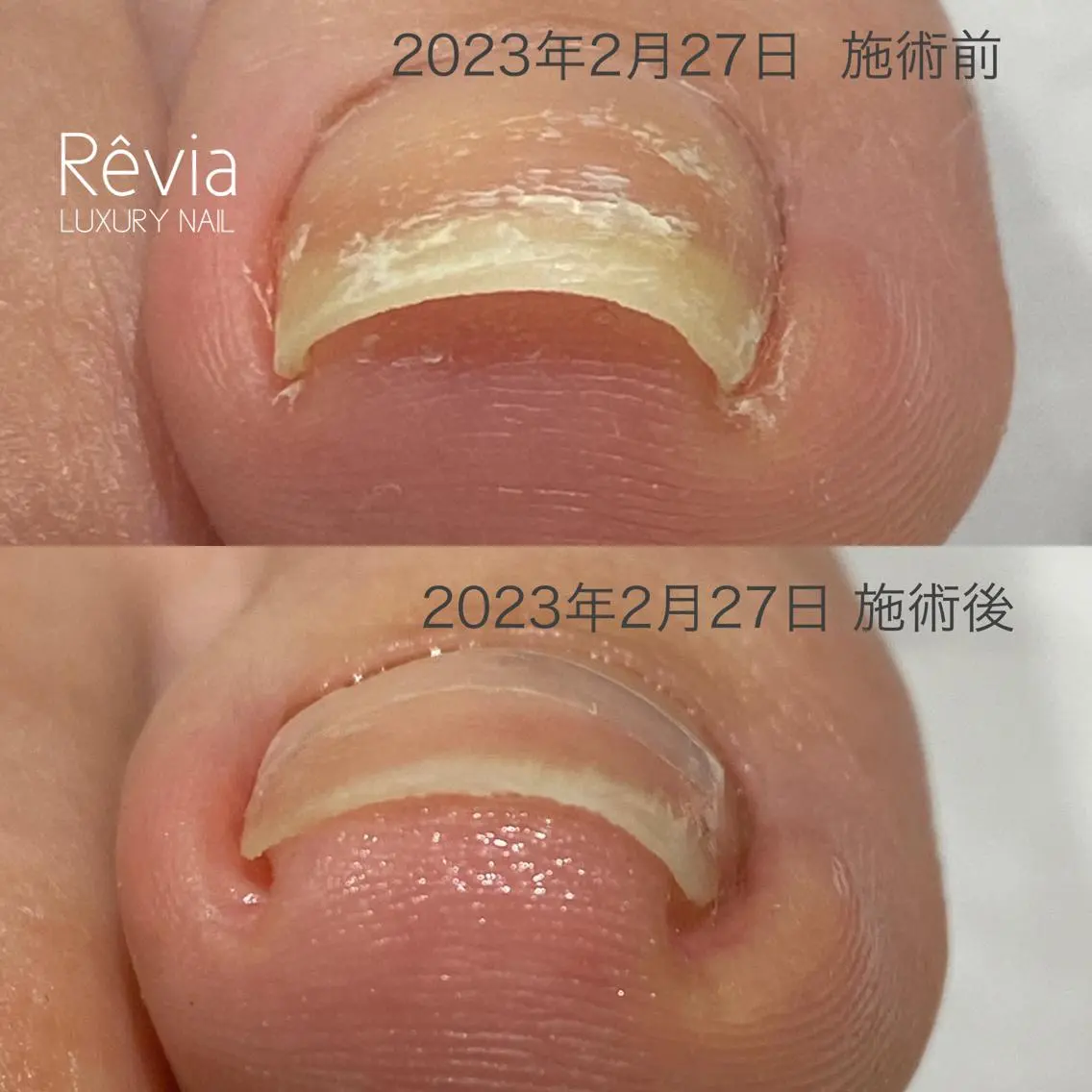 ネイル フットネイル プライベートサロン Rのネイルデザイン