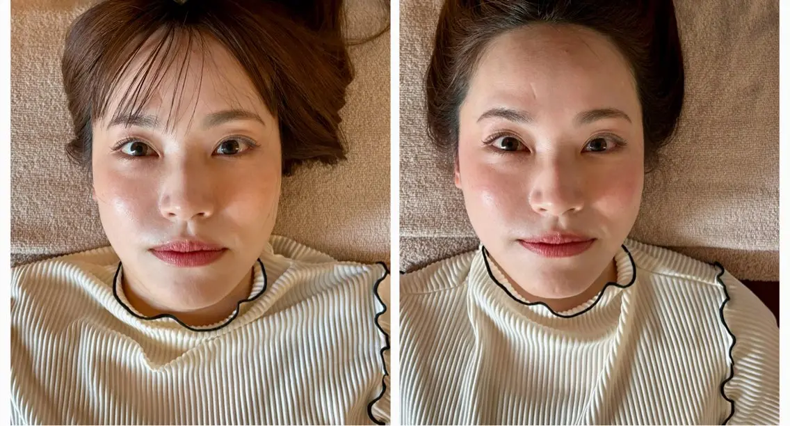 神速スッキリ！脳疲労リセットヘッド × 頭皮エア美容鍼【ミニモ限定】の写真