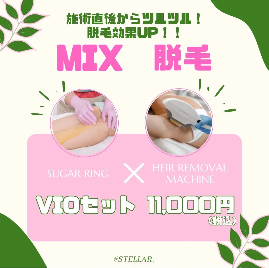 VIO MIX脱毛の写真