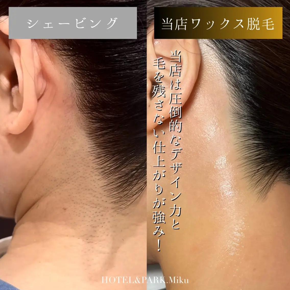 HOTEL&PARK Mikuワックス脱毛のエステ・リラクイメージ