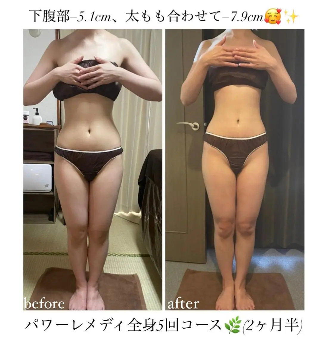 《本気痩せ×疲労改善 》 BILOOPのエステ・リラクイメージ