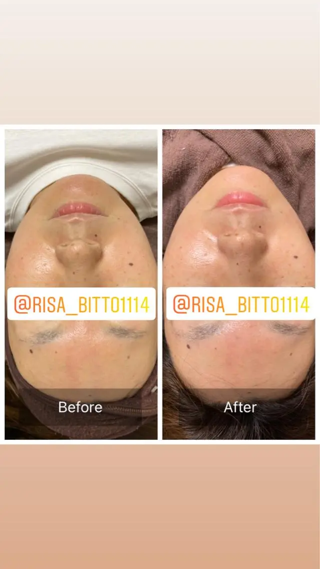 フェイスWaxの写真