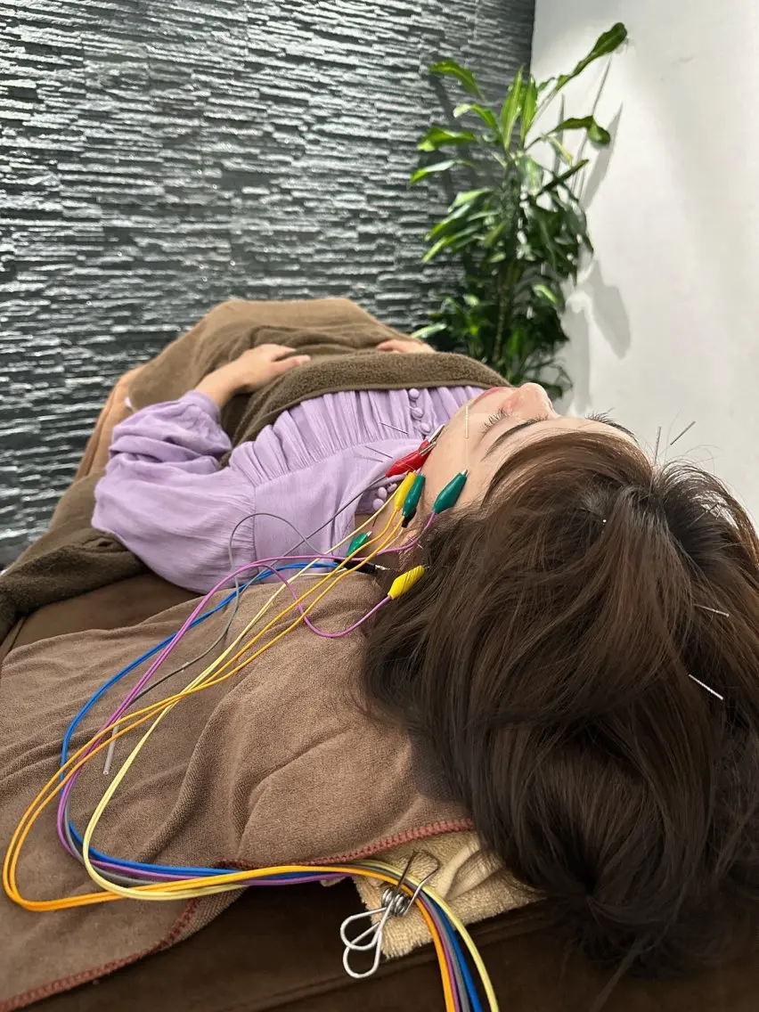 その他 小顔矯/美容鍼/鍼灸 BeauJuのその他イメージ