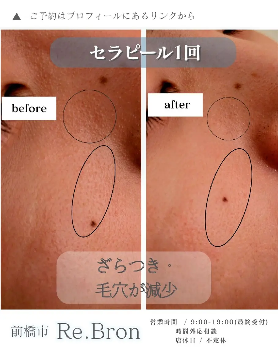 エステ リラク たるみ・ くすみ シミ・ニキビ肌改善のエステ・リラクイメージ