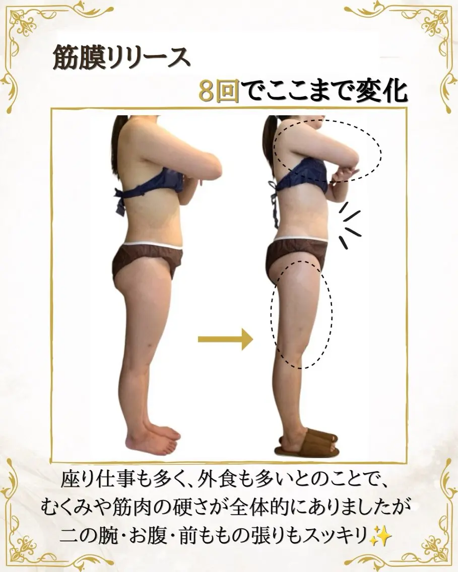 筋膜×深部温熱 リラク★痩身RIONのエステ・リラクイメージ