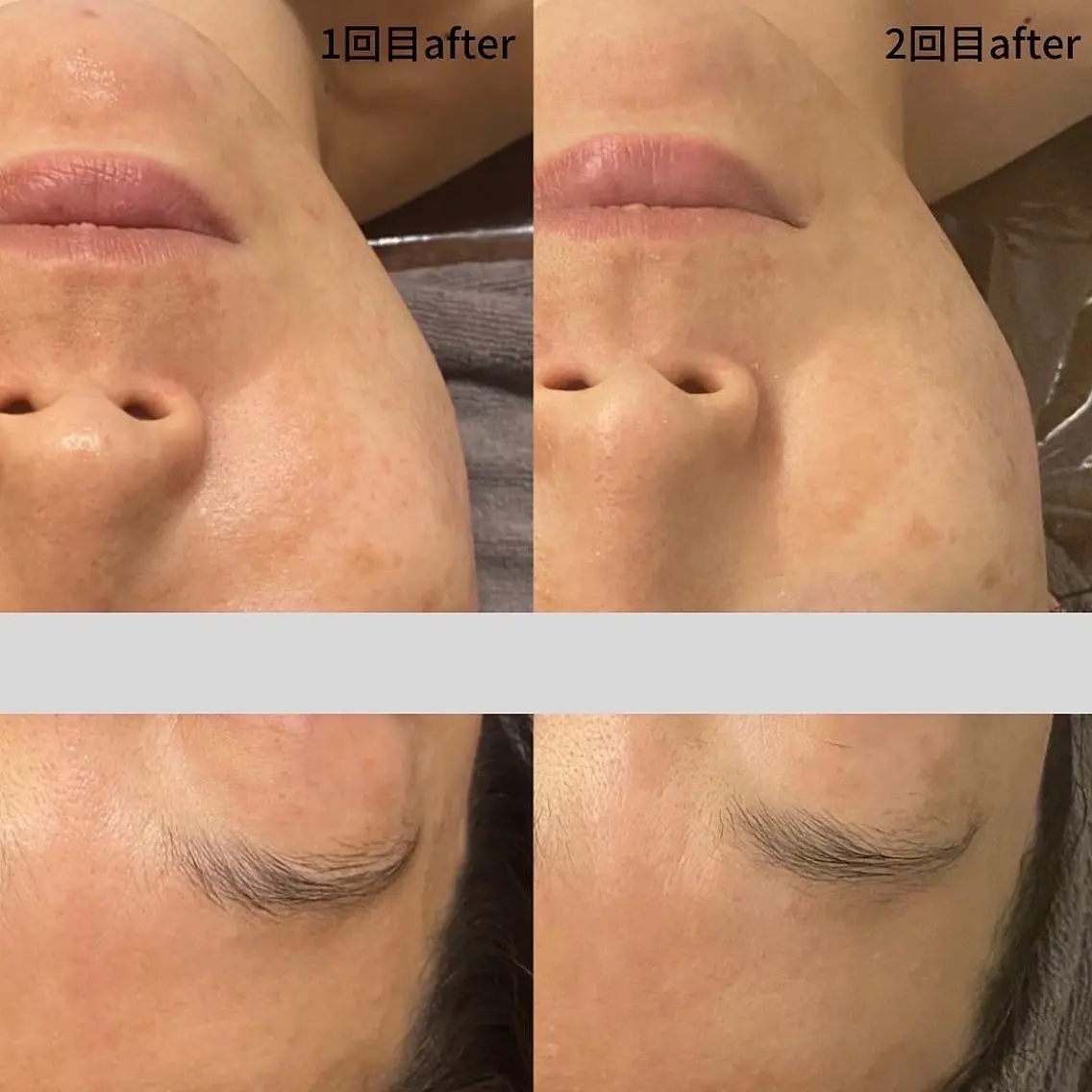DUPE&MORE 店長kanaeのエステ・リラクイメージ