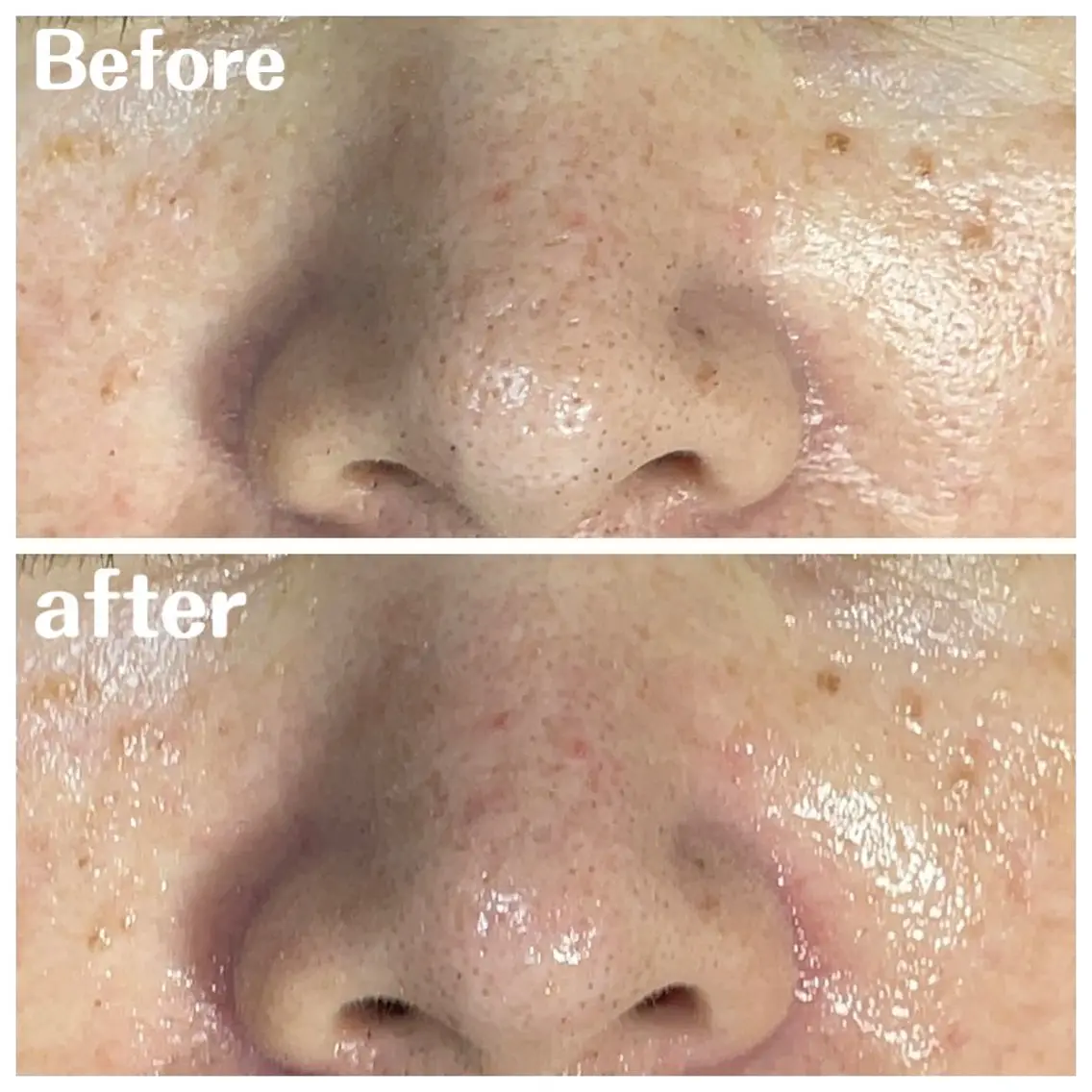 肌質改善サロン facialmoonのエステ・リラクイメージ