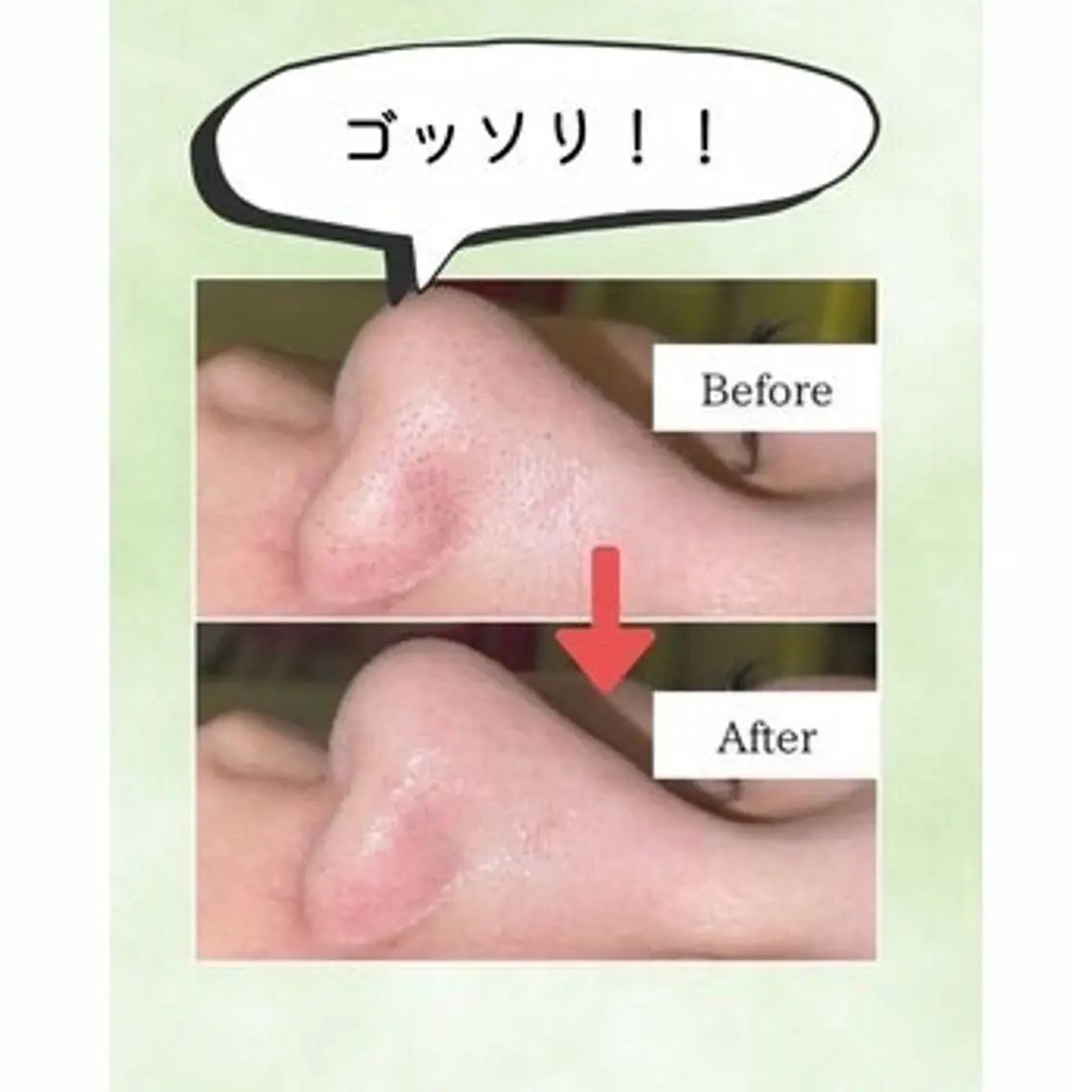 毛穴レス肌へ!ハイドラフェイシャルの写真