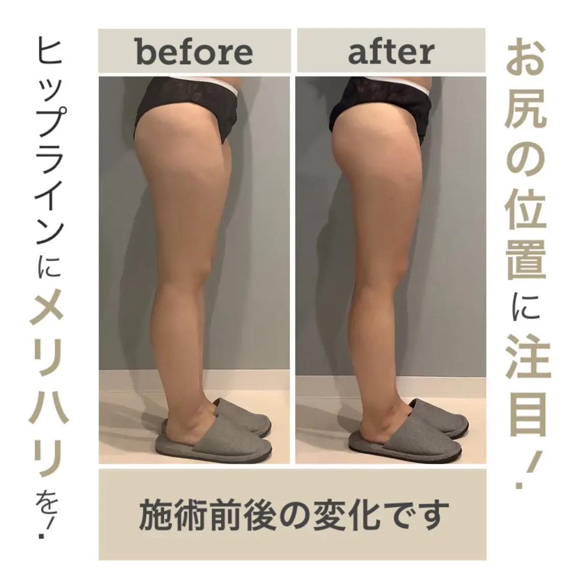 エステ エステサロン JURISのエステ・リラクイメージ